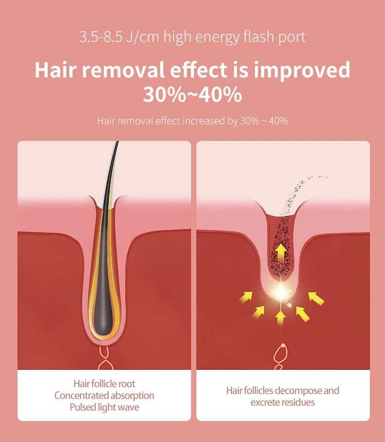 Advanced Glowy Skin Laser Hair Removal Home USE Machine Intense Pulsed Light Technology Armpit ICE Cool IPL Hair Removal Device