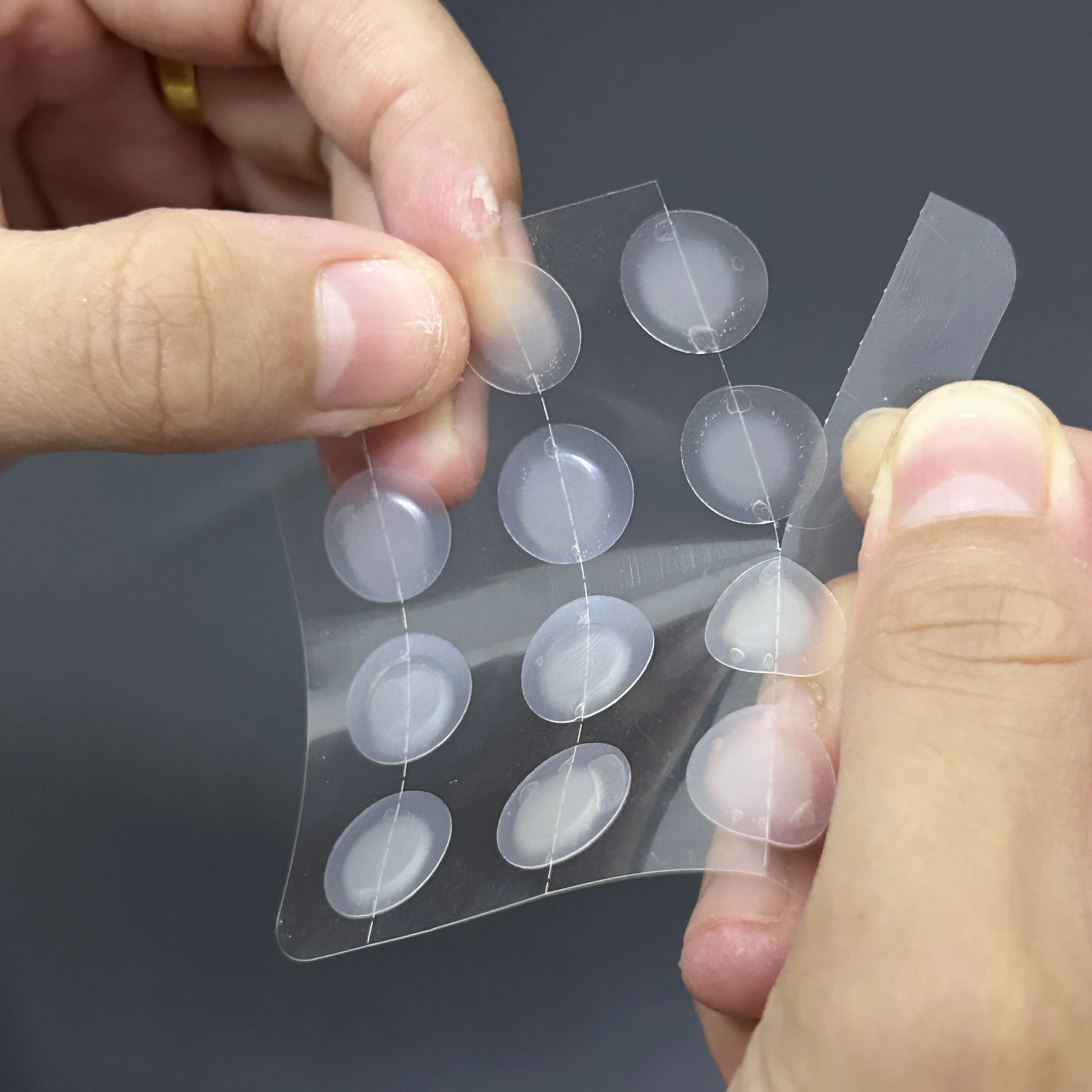 Thin Edge Acne Pimple Patches - Pack of 12 Translucent Hydrocolloid Patch Spot Treatment Zit Stickers for Face and Body