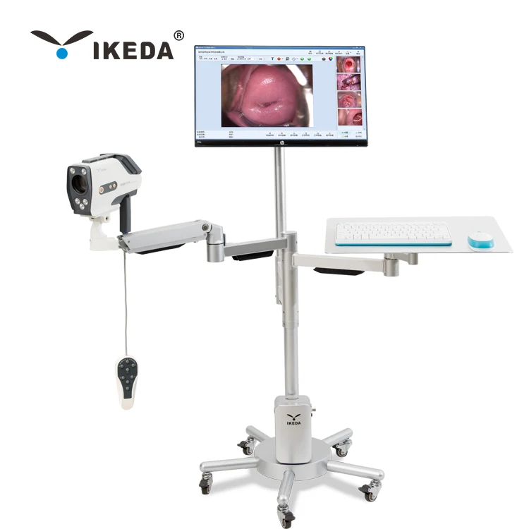 High resolution colposcope video camera colposcopy exam system digital colposcope AKX  YKD-3001