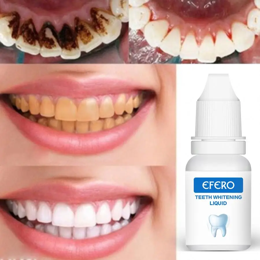 EFERO teeth whitening Powder kit Oral Hygiene product easy white teeth whitening teeth whitening serum essence liquid