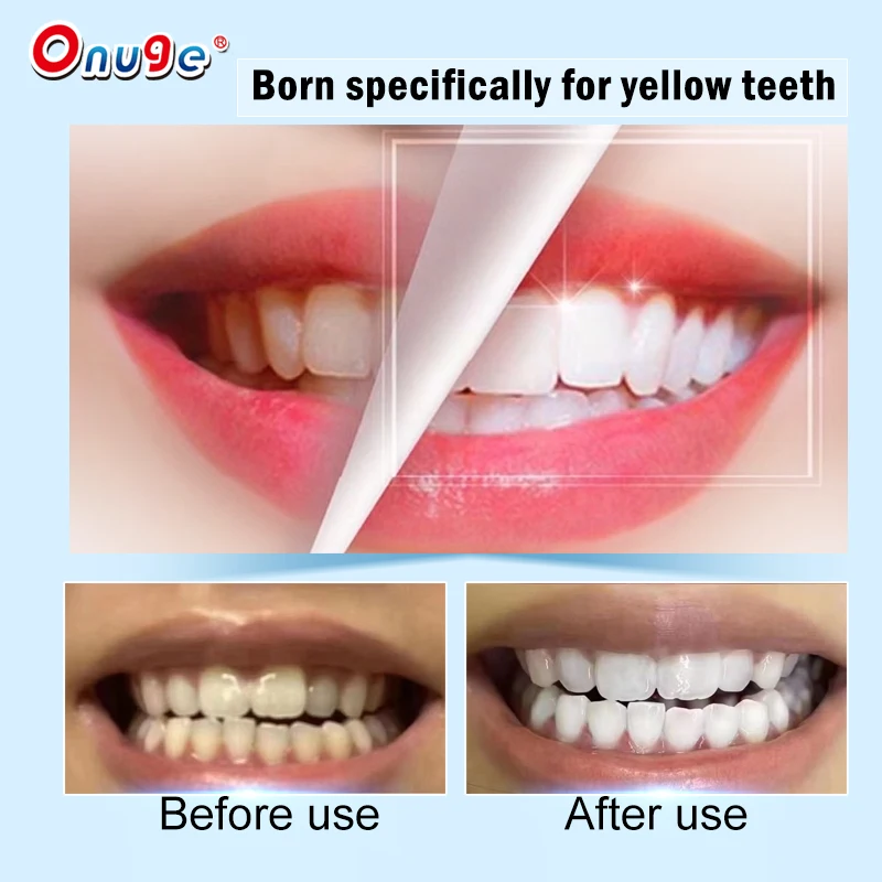 Onugesmile CE Approved Mint Flavor 14 Pairs Alcohol Free Teeth Whitening Strips