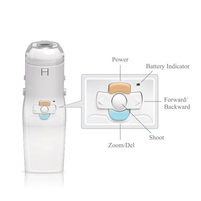 Portable Mini Colposcope Handheld Digital Video Colposcope for gynecology clinic home use video colposcopio digital portatil