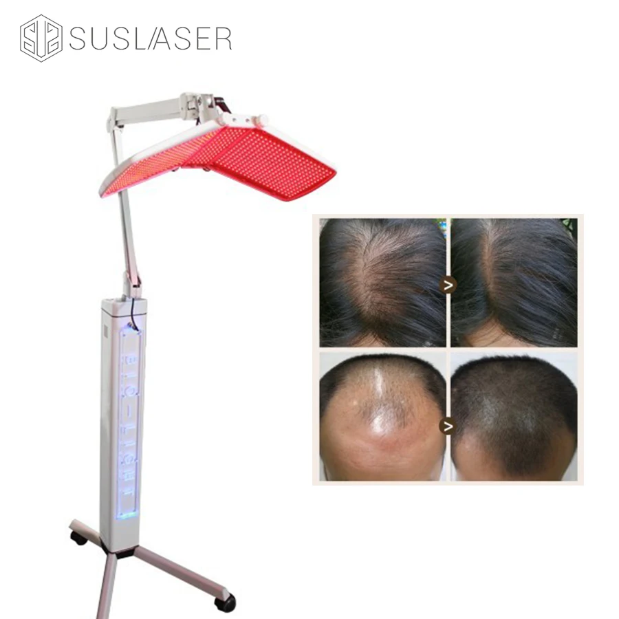 
SUS PDT Led Cold Laser Machine To Grow Hair And Preventing Hair Loss 