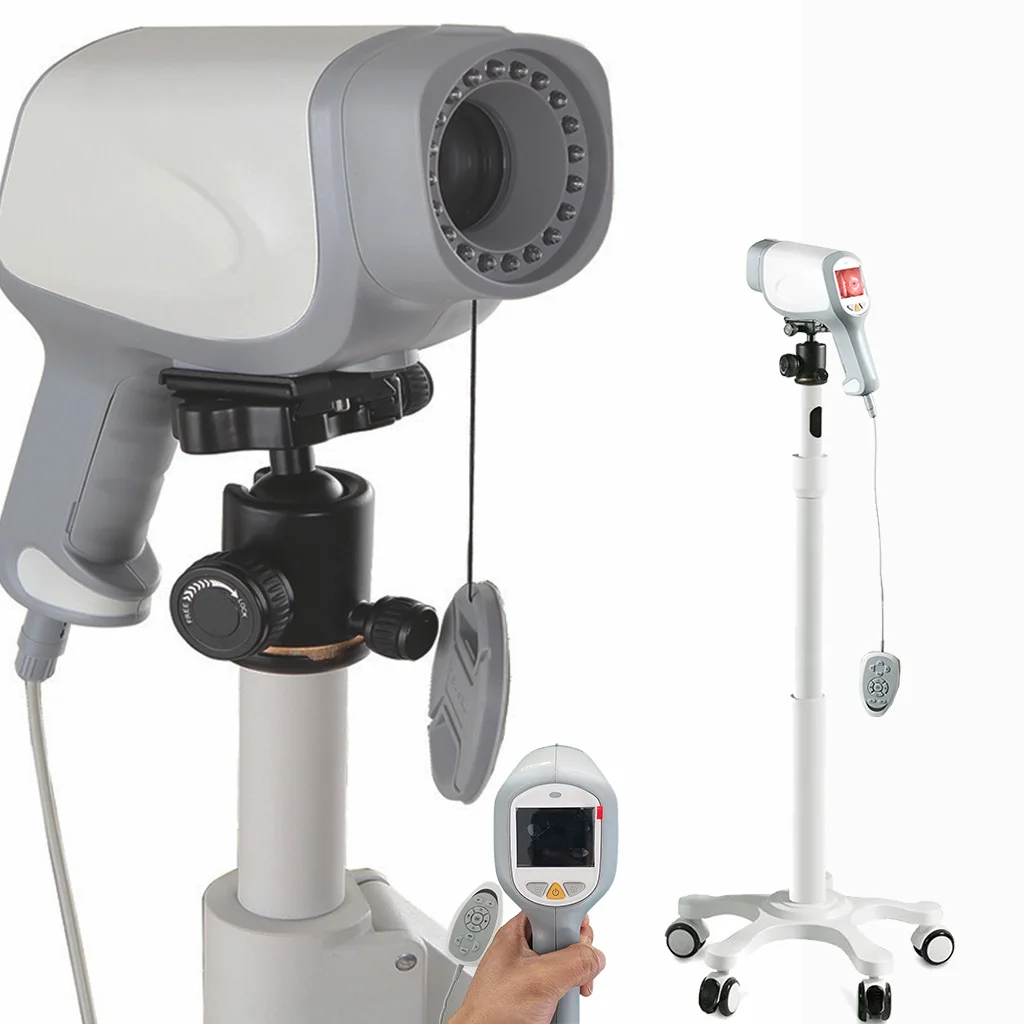 Medical CE Handheld Colposcope Portable Gynecology Colposcopy System Digital Electronic Gynecology Video Colposcope
