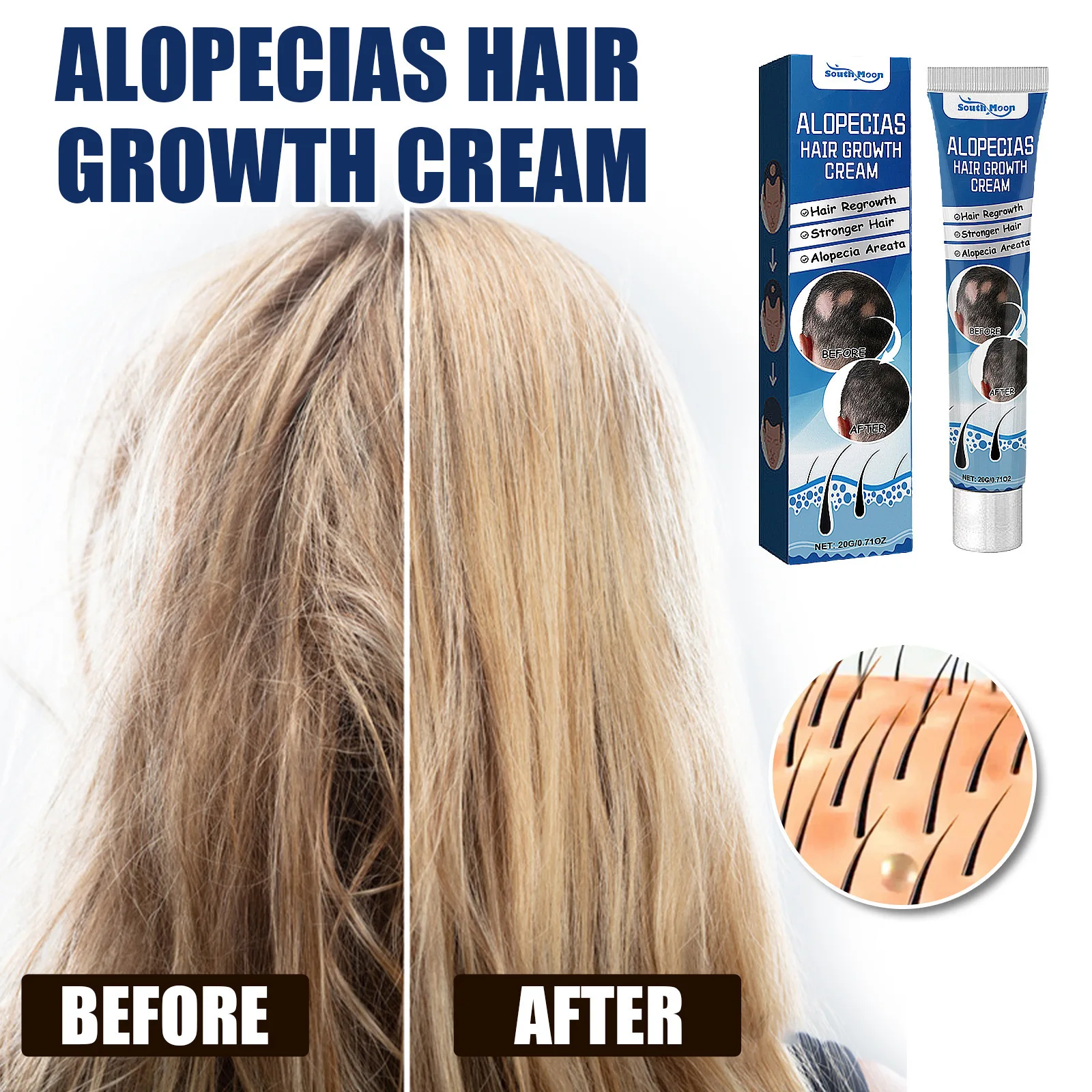 OEM Scalp dense hair care cream Cares for follicles to strengthen hair moisturize thick hairline and strengthen hair