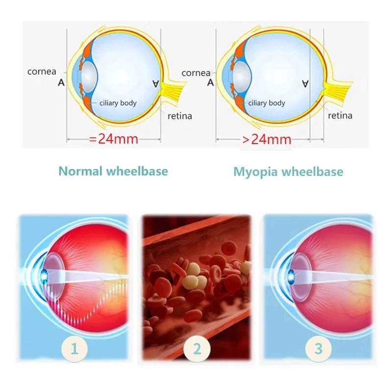 Eyerising Myopia Device Vision Care Eye Massager for Dry Eyes Discomfort Presbyopia Fatigue Relief for Home Use