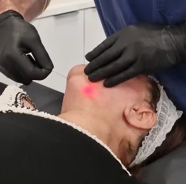 Endolaser diode 980 nm 1470 vaser liposucion 1470nm diode laser single wavelength face lifting endoskin laser