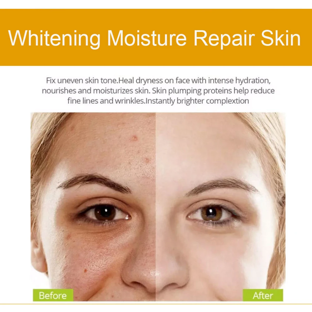 Private Label Brand Vitamin C Serum Kojic Acid Serum VC Cream Skin Care Remove Dark Spots Salud y Belleza Whitening Face Secrum