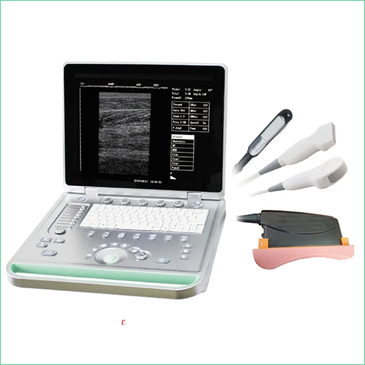 Portable ultrasound scanner vet veterinary equine ultrasound sonoscape equipment
