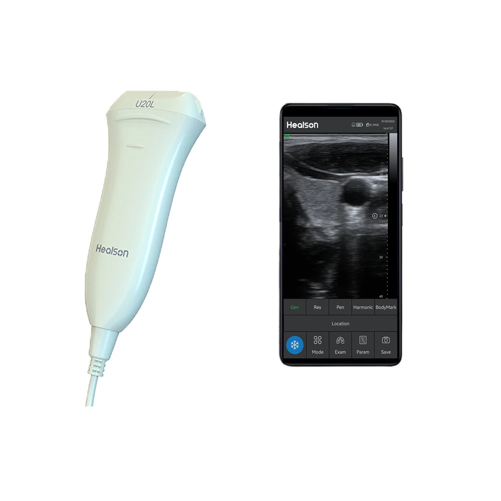 U20L USG Full Digital Mini Ultrasound Price Portable Ultrasound Machine Medical Instruments With Smartphone