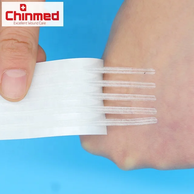 Wound skin closure surgical in medical adhesive