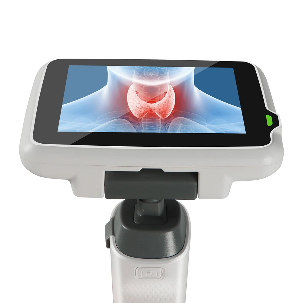 Portable camera Bronchoscope Durable High-Definition Anesthesia Video Laryngoscope for Airway Trachea Intubation