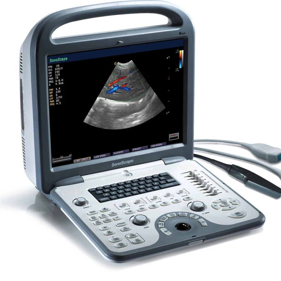 Good Quality Veterinary Portable Color Doppler Ultrasound Machine Sonoscape