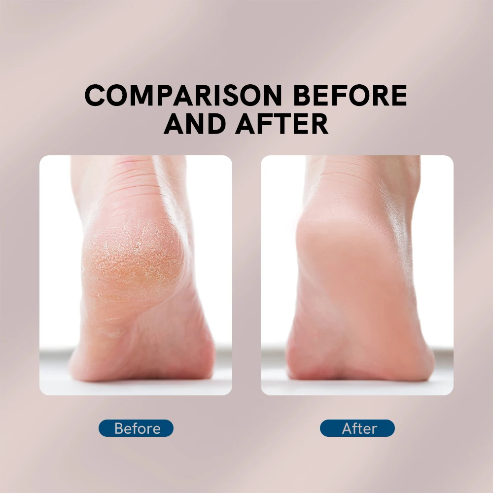 Electric Foot File For Heels Grinding Pedicure Tools Professional Foot Care Tool Dead Hard Skin Callus Remover Beauty Care