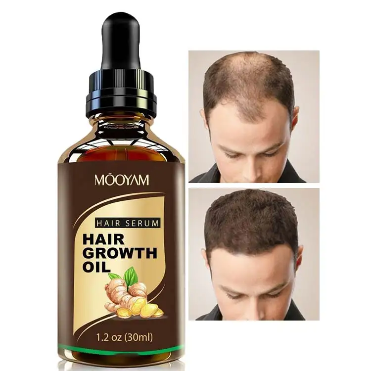 Results Guaranty in 30 Days Private Label Men Hair Loss Treatment Biotin Hair Growth Serum Oil