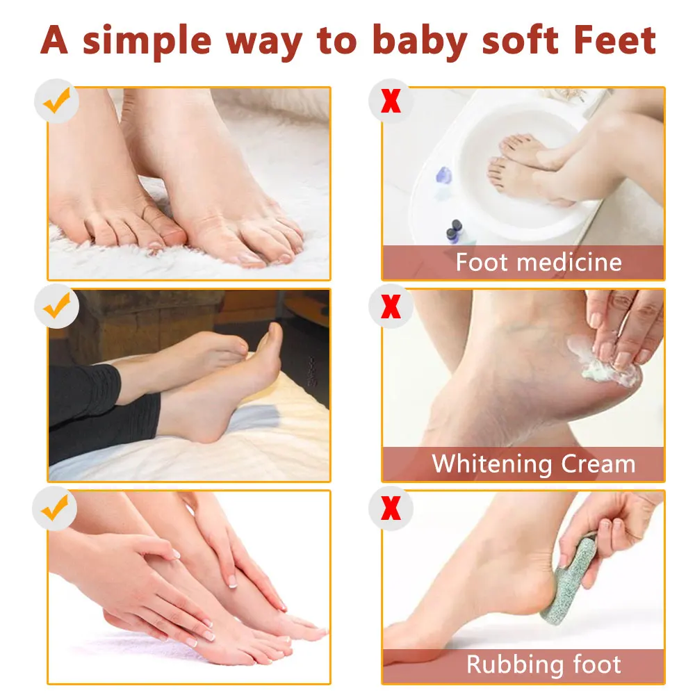 OEM Wholesale Top Feet Treatments Natural Vegan Ginseng Exfoliating Peeling Foot Care Mask