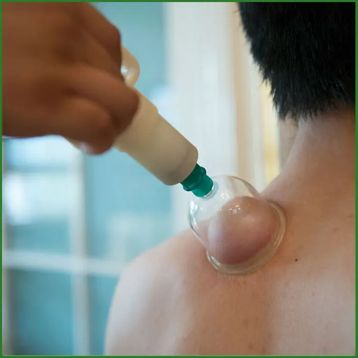 NEW VACUUM CUPPING SET 24 CUPS Therapy Massage cupping best Acupuncture needles