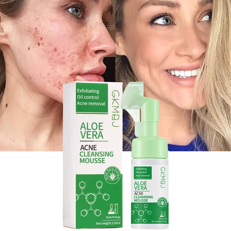 microbial ferment skin care,pore shrink oil control whitening face wash,aloe vera anti acne removal facial cleanser mousse