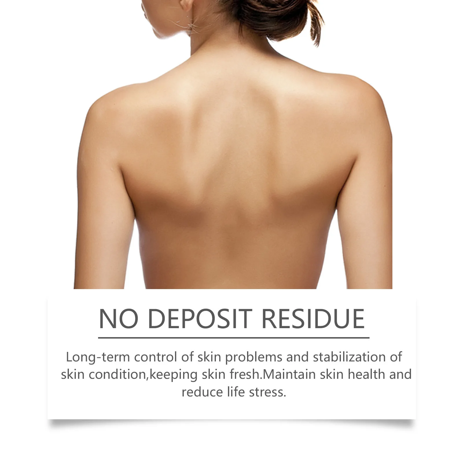 Private label BEE VENOM 20g psoriasis ointment acne dermatitis scrotum eczema pityriasis urticaria psoriasis treatment cream