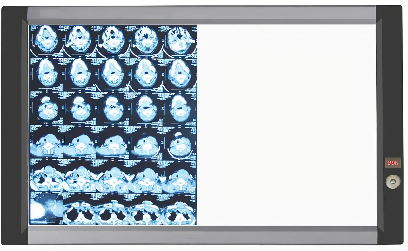 wholesale medical hospital blue x-ray film viewer with high quality