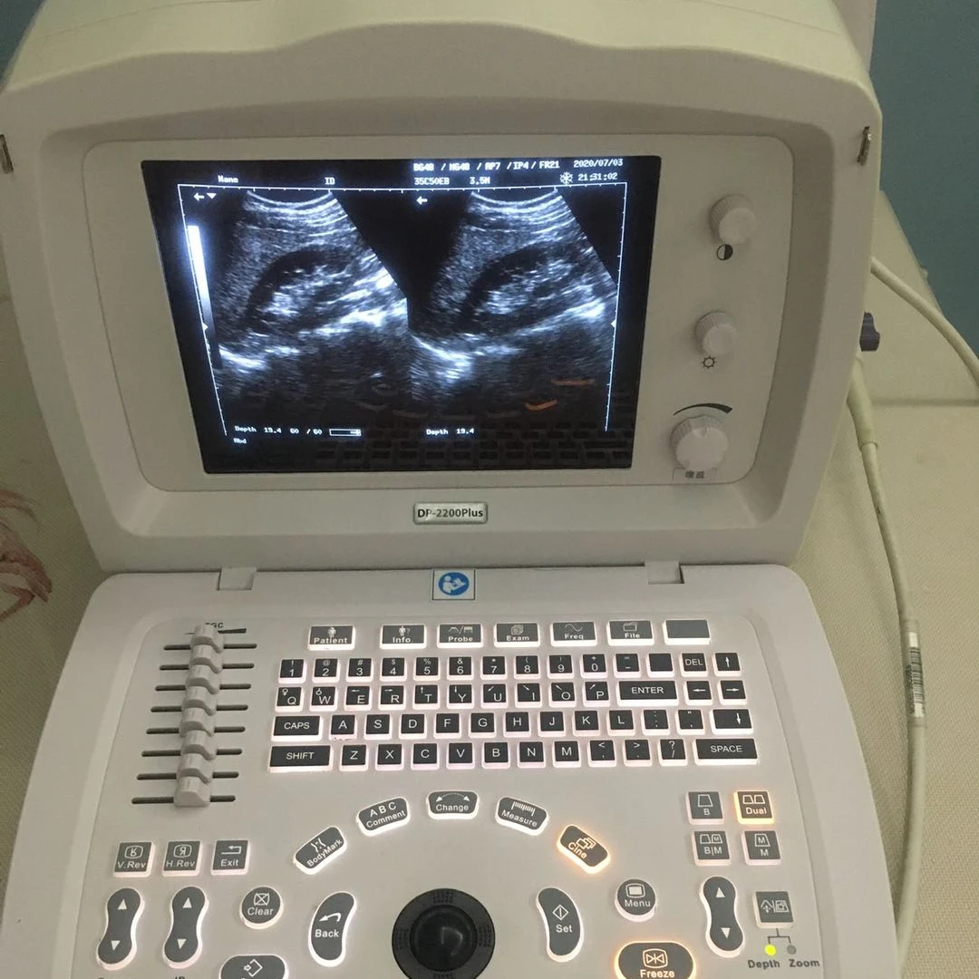 Used Mindray DP2200 plus protable ultrasound scanner with convex probe, best price