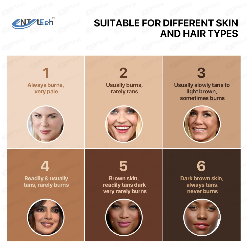 Unique shell 808 755 1064 single handle diode laser hair removal skin rejuvenation machine promotion price