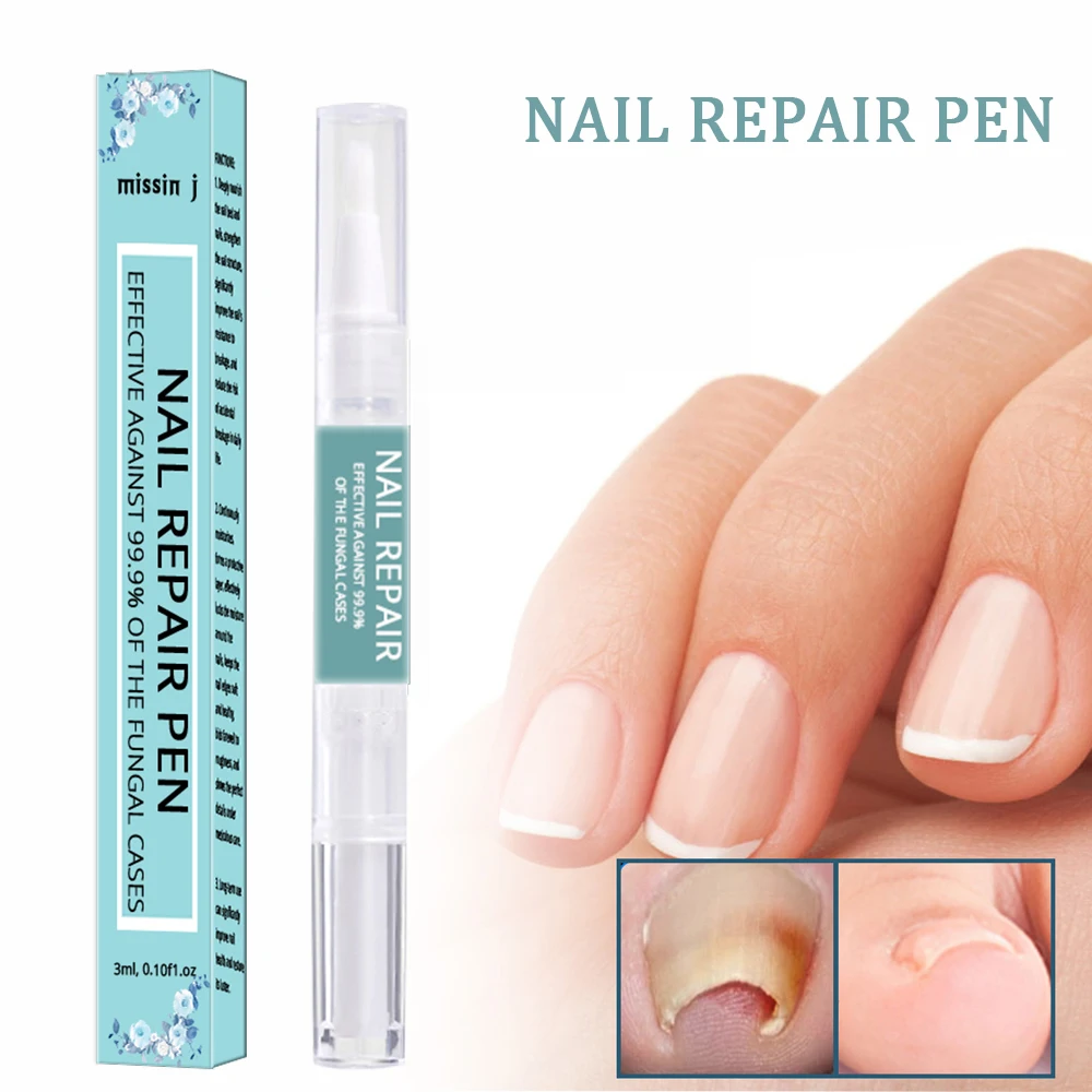 Private Label Anti Fungal Nail Fungus Treatment Repair Pens for Toenail Fungus Infection and Fingernail