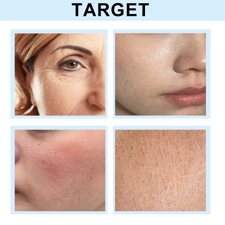 Hyaluronic Acid Cream Hyaluronic Acid Intense Hydrating Moisturizer Antiaging Anti Wrinkle Face Cream