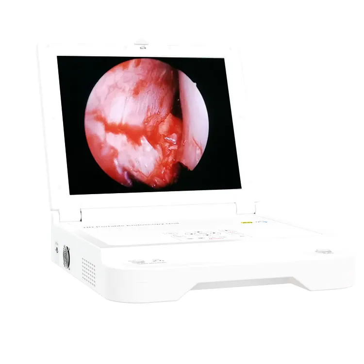 low price hd portable laparoscopic hysteroscope system from factory medical manufacturer