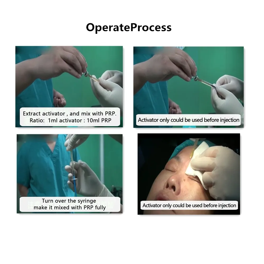 Sodium Platelet Rich Plasma PRP Activator