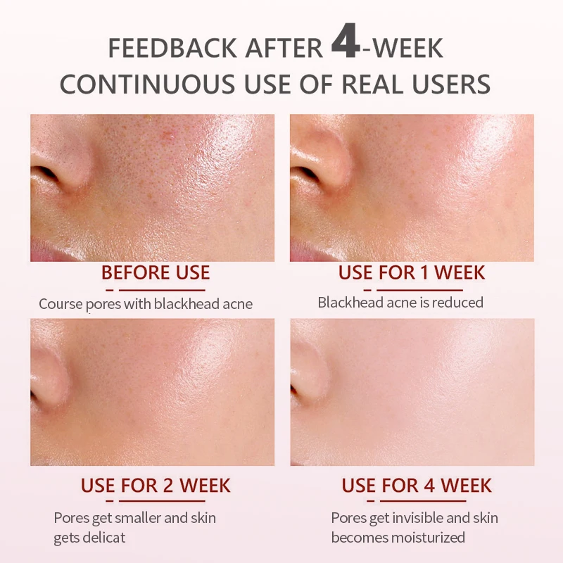 High Quality 30ml Skin Care Products Serums Vitamin C Anti Aging Brightening Whitening Face Serum For Hyper-Pigmentation