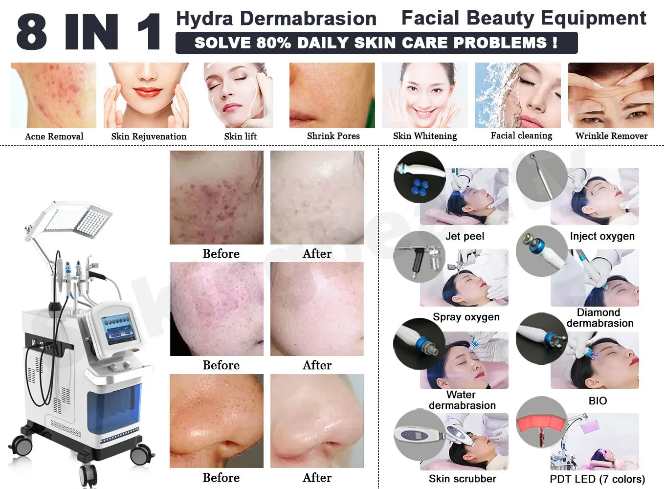 hydro water facial oxygen hydrogen water generator 8 in 1 jet peel hydradermabrasion diamond micro dermabrasion for sale