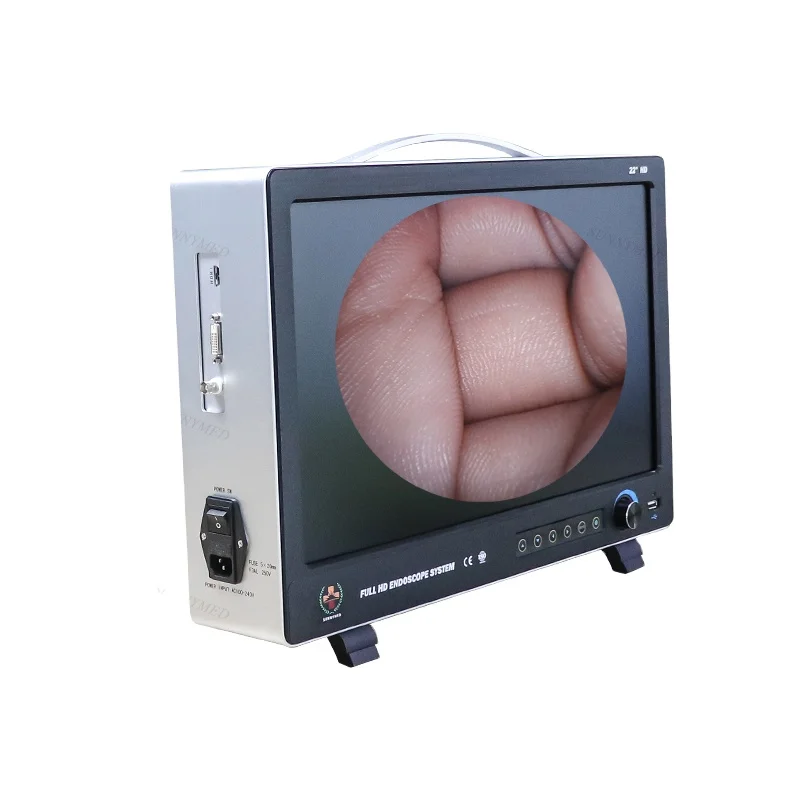 Эндоскоп HD laparascope эндоскоп для Hysteroscopy/артроскоп