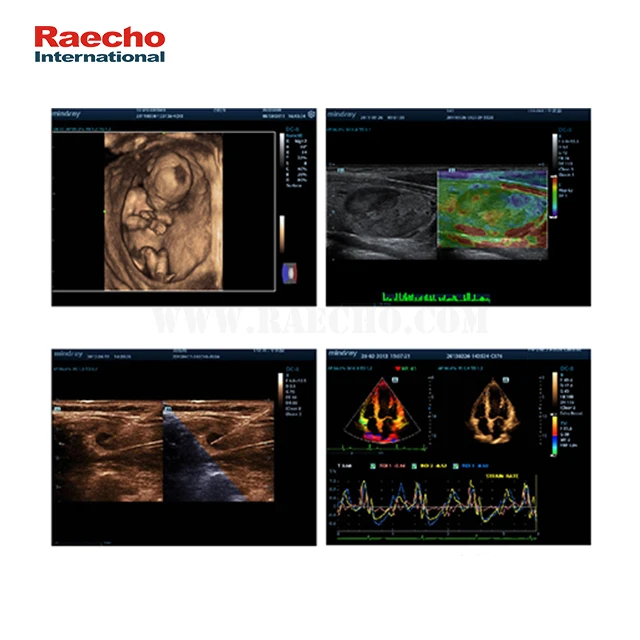 Mindray Optical Electronic Trolley Diagnostic Ultrasound Machine