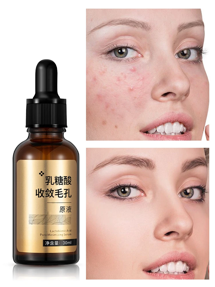 Private Label Skin Care Lactobionic Acid Facial Serum Cosmetics Shrinking Pores Face Serum Control Oil Anti Acne Serum For Face