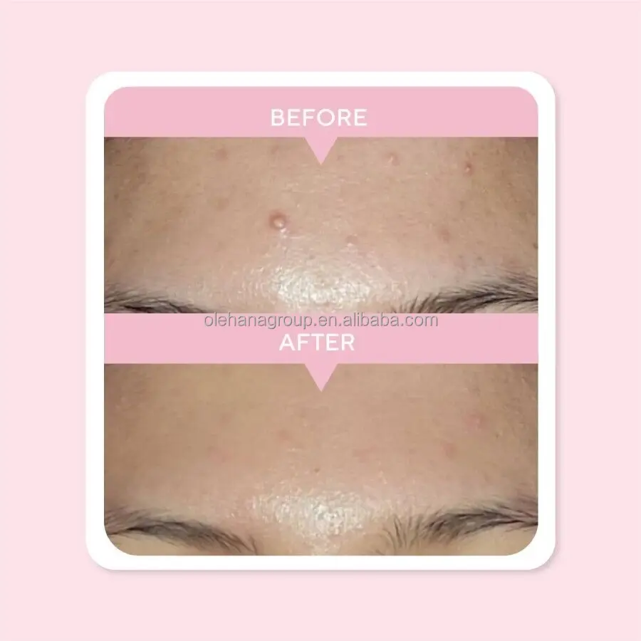 Private Label Korean Skincare Anti Aging Hyaluronic Acid Niacinamide Vitamin C E Skin Care Face Serum Facial Whitening Serum