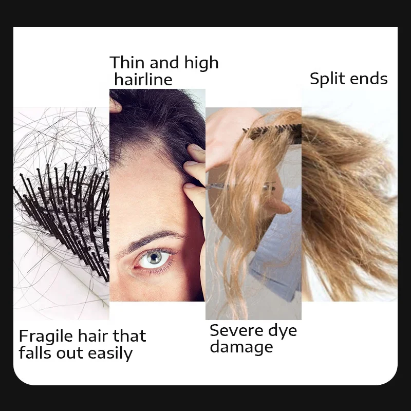 OEM Custom Private Label Hair Treatment Smooth Repair Hair Loss Thicker Ginger Hair Growth Oil Serum