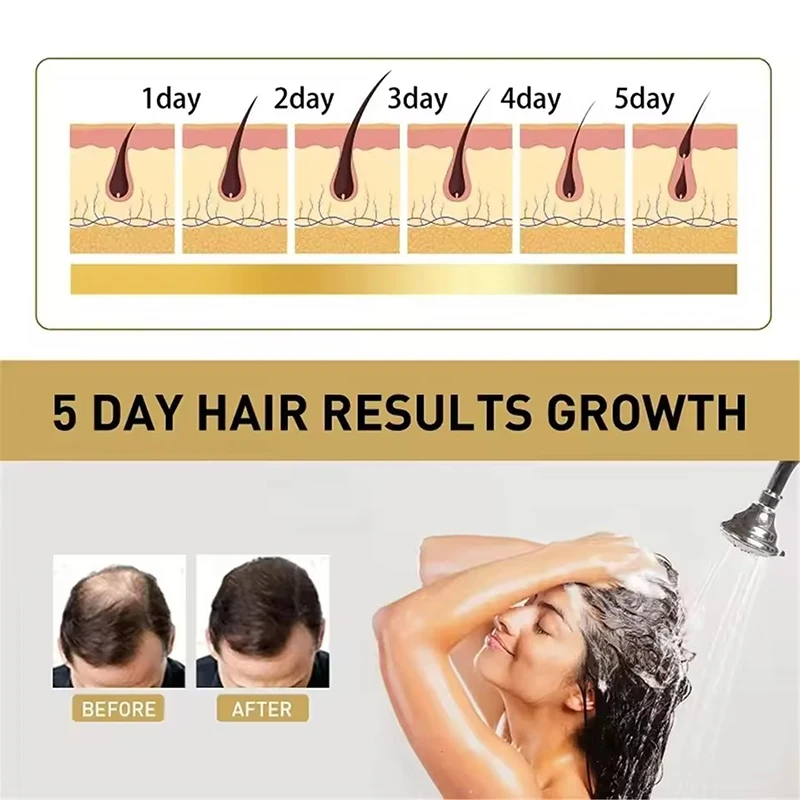 Private Label Natural Moisturizing Anti loss Hair Wash Vegan Hair Growth Biotin Shampoo And Conditioner Kit