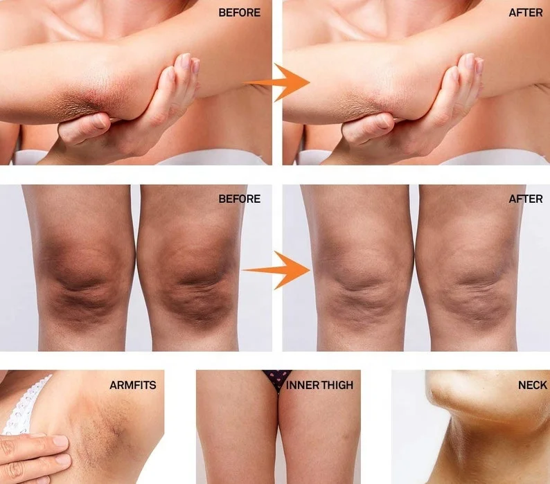 Private Label Intimate Skin Whitening Gel Lightening Body Bleach Cream, Vaginal/Anal Bleaching - Safe for intimate