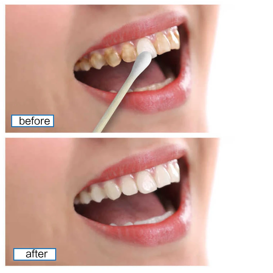 EFERO Deep Cleaning Coffee Tea Stains Removal Natural Teeth Whitening Serum