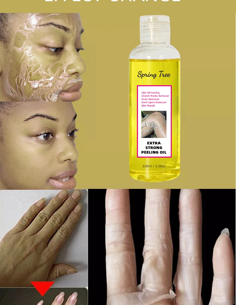 Super Strength Yellow Peeling Oil whitening Elbows Knees Hands Melanin Bleaching Dark Skin Strong Peeling Oil