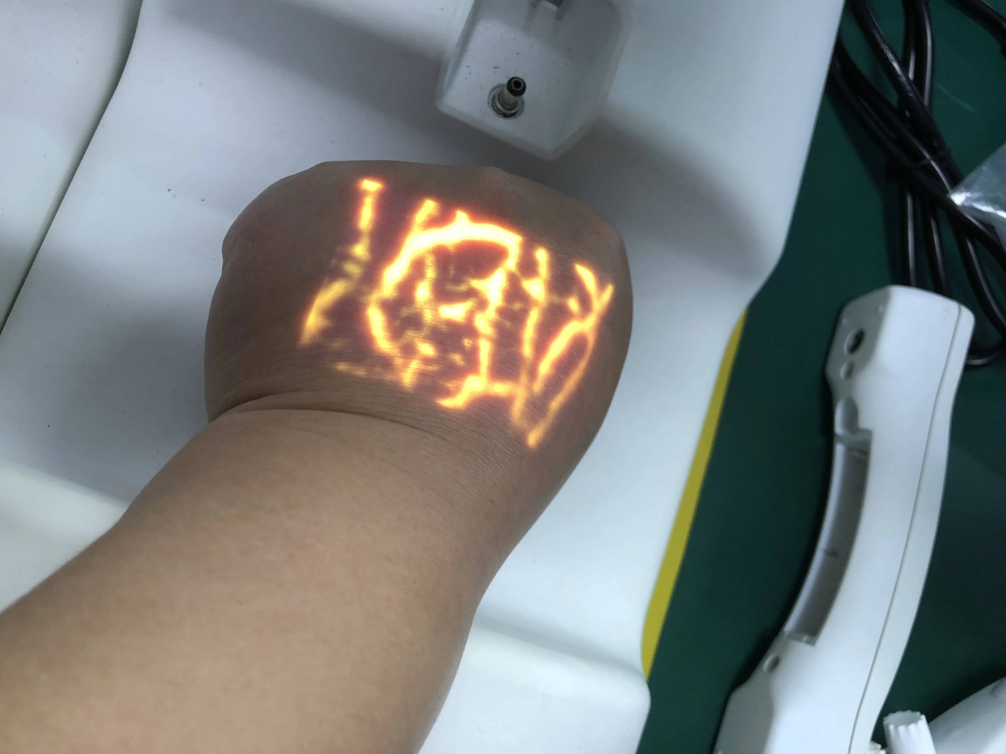 
mobile model medical vein locator infrared adjustable projection vein finders 