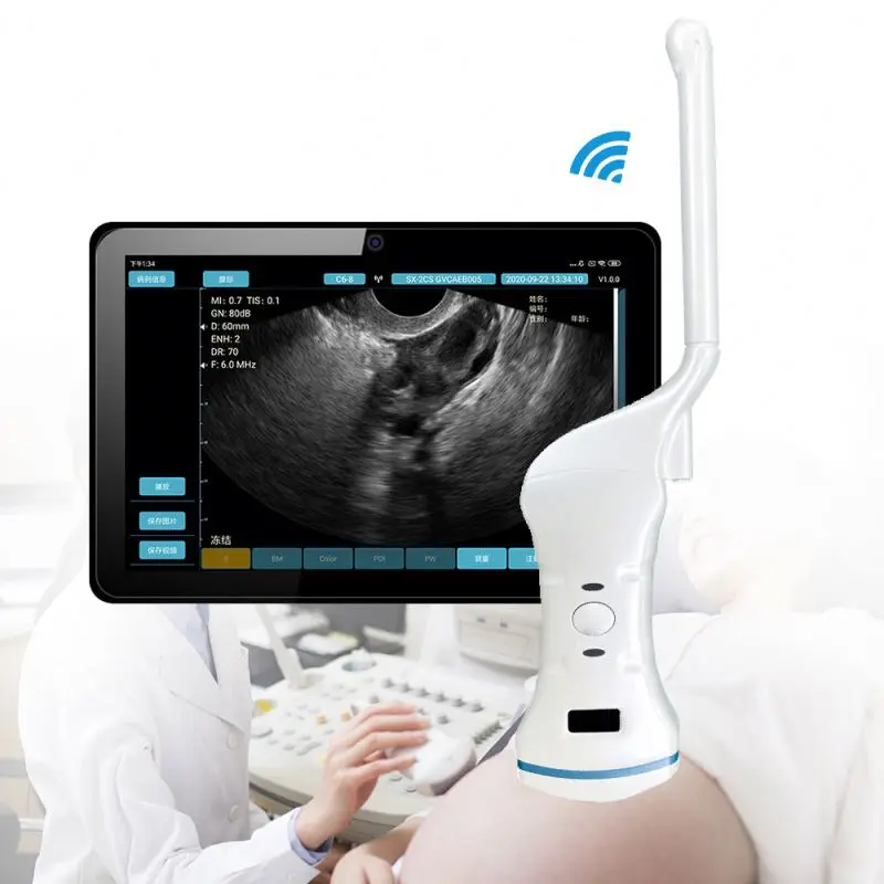 Medical Imaging Equipment Portable wireless wifi ultrasound scanner transvaginal ultrasound probe wireless