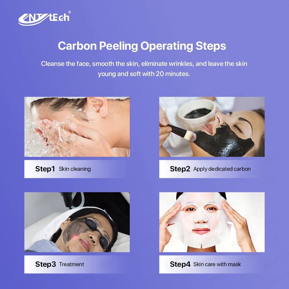 Factory price 1064nm q switch nd yag laser machine laser tattoo removal