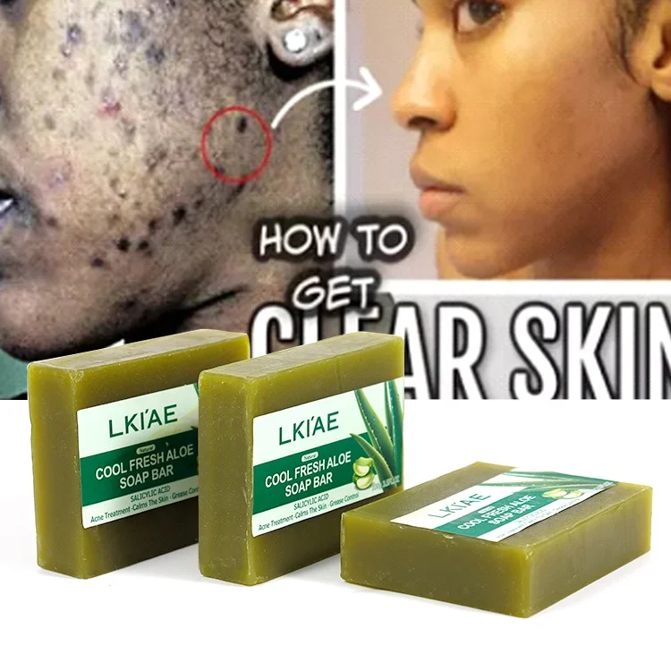 Cosmetics Whitening Kojic Acid Soap Skin Lightening Deep Cleaning Koijc Bleaching Anti Acne Hand Made Soap