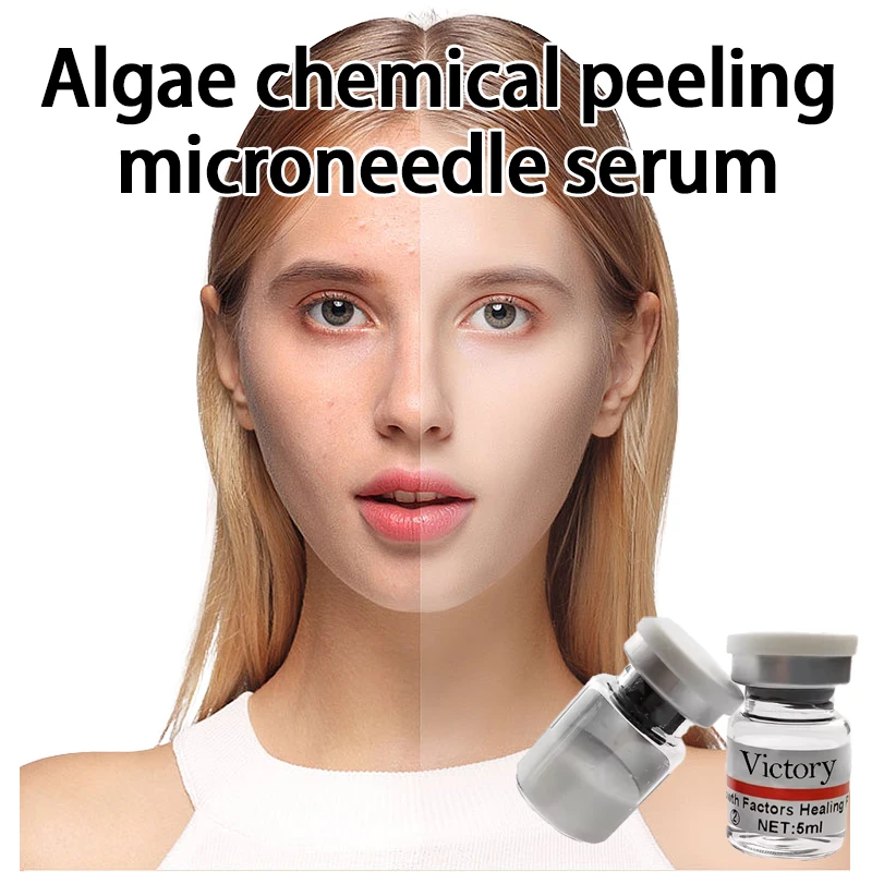 Epidermal Growth Factors Healing Power Human Korea Like For Post Algae Chemical Peel Microneedling Micro Needling Serum