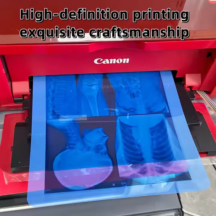 Factory price hot sale Inkjet Blue Medical dry film transparent blue X-ray film for CT DR MRI Radiological device