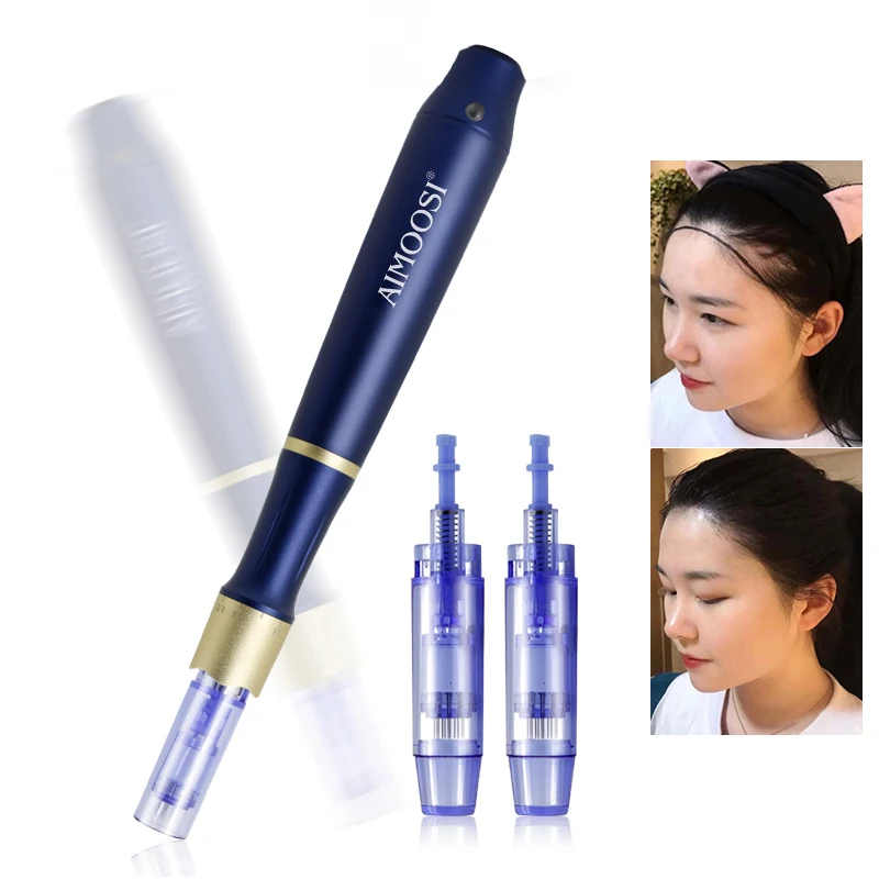 AIMOOSI S6 MTS Hair Growth Introduction Instrument Advanced Nano Crystalline Microneedle Device for Hair Regeneration