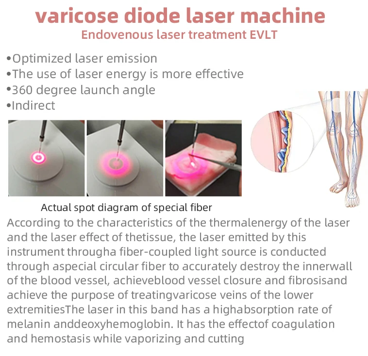 2024 Newest 980nm 1470 diode laser spider vein removal machine 980nm vascular laser machine