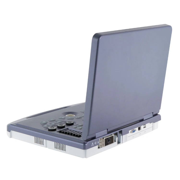 Digital Ultrasound Scanner Cheap Linear Ultrasound Scanner Bondway Ultrasound Scanner Fetal